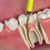 اتوکلاو استریل فور