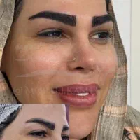 کاشت مو و ابرو با تراکم بالا آف تا آخر ماه|خدمات آرایشگری و زیبایی|شوشتر, |دیوار