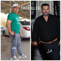لاغری صد در صد تضمینی با دستگاه بدون عمل جراحی|خدمات آرایشگری و زیبایی|اهواز, پادادشهر|دیوار