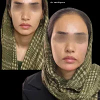 اف ویژه تمام خدمات زیبایی و جراحی در مطب|خدمات آرایشگری و زیبایی|یاسوج, |دیوار