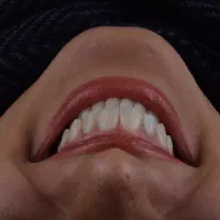 دستیار دندانپزشکی محدوده فلسطین