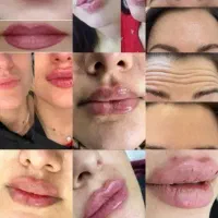 50٪تخفیف خدمات فیلر بوتاکس مزوتراپی پرسینگ چال لپ|خدمات آرایشگری و زیبایی|اصفهان, مولوی|دیوار