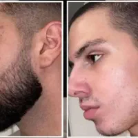 ریش پرپشت،اعتماد به نفس بیشتر