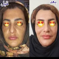 کرمات تصمینی|آرایشی، بهداشتی، درمانی|سوسنگرد, |دیوار