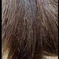 موخوره گیری مو نصف قیمت۳۵۰