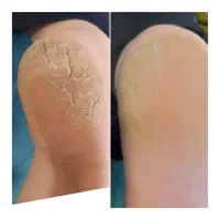 تمام خدمات سالن زیبایی|خدمات آرایشگری و زیبایی|بهبهان, |دیوار