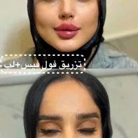فیلر و بوتاکس ویژه عید مطب هر سیسی۹۸۰ هزار