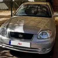 هیوندای ورنا استثنائی کاملا نو - Hyundai verna