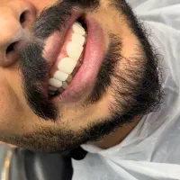 کامپوزیت دندان|خدمات آرایشگری و زیبایی|اندیشه, اندیشه فاز ۲|دیوار