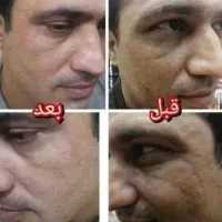 حراج کرم سوپر معجزه اصلی ۷۴ترکیبه ضدلک جوش روشن کن|حراج|شیراز, احمدی جنوبی|دیوار