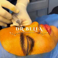 جشنواره ویژه بلفاروپلاستی(جراحی زیبایی پلک)