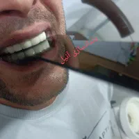 دندان سازی|خدمات آرایشگری و زیبایی|خوی, |دیوار