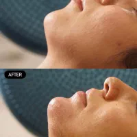 کلینیک زیبایی باران رشت لیزر فیلر و بوتاکس