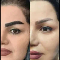 کاشت ابرو کاملا تخصصی با تخفیف۳۰درصدی تضمینی تبریز