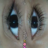 آموزش کاشت موقت و لیفت و لمینت