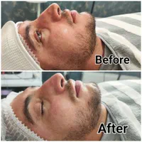 فیشیال تخصصی/پاکسازی پوست/ اسکین کر/پیلینگ شیمیایی|خدمات آرایشگری و زیبایی|شیراز, زند|دیوار
