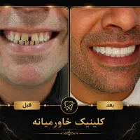بزرگترین جشنواره سال دندانپزشکی درمجهزترین کلینیک|خدمات زیبایی و سلامت|شیراز, عفیف‌آباد|دیوار