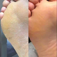 خدمات کفسابی و پدیکور (درمانی و زیبایی )پا|خدمات آرایشگری و زیبایی|مشهد, وکیل‌آباد|دیوار