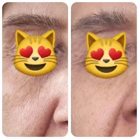 کرم بیوممتیک ۵ کاره(جایگزین بوتاکس قیمت قبل)+4هدیه