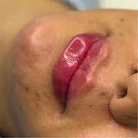 تزریق ژل و بوتاکس اف تا فردافقط۹۸۰|خدمات آرایشگری و زیبایی|یاسوج, |دیوار