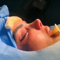 عمل بینی دکتر اسدالله پور