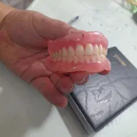 ساخت انواع پروتزهای متحرک