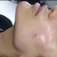تخفیف باورنکردنی ژل، بوتاکس، آموزش|خدمات آرایشگری و زیبایی|شیراز, معالی‌آباد|دیوار