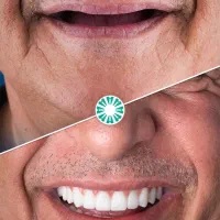 ارائه خدمات دندان پزشکی (ایمپلنت)