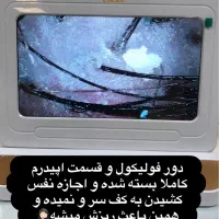 کراتین(بوتاکس واحیاودرمان اسکالپ اسکراب مو)|خدمات آرایشگری و زیبایی|رشت, گلسار|دیوار