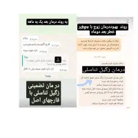 قارچ شیتاکه بهبود زگیل تناسلی|آرایشی، بهداشتی، درمانی|رشت, بازار|دیوار