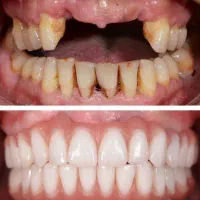 اوردنچر فقط تااخر این هفته به قیمت پارسال|خدمات زیبایی و سلامت|تبریز, |دیوار