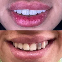 طرح لبخند*بی‌نظیرترین کیفیت*کمترین قیمت دندانپزشکی|خدمات آرایشگری و زیبایی|شیراز, ملاصدرا|دیوار