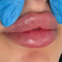 جشنواره خدمات تخصصی زیبایی،فیلربادی