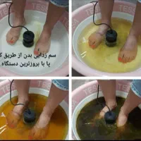 حجامت فصدپیشانی زالو