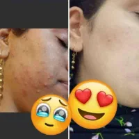 محصولات جوانسازی و روشن شدن پوست تا عید