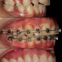 ارتودنسی و تمام خدمات دندانپزشکی اقساطی