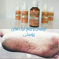خراطین|آرایشی، بهداشتی، درمانی|محمدشهر, محمدشهر|دیوار