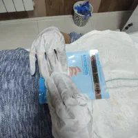 فیشال /کربوکسی تراپی /پلاژن تراپی /اسید تراپی