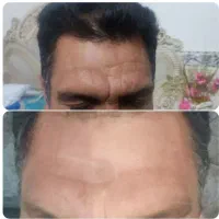 هدیه ۲۰۰|کارت هدیه و تخفیف|خرم‌آباد, |دیوار