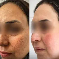 سفید شو و جوان شو (بیوممتیک) پرداخت درب منزل