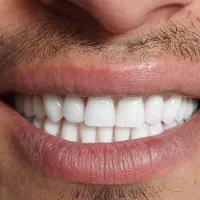 دندانپزشکی اقساطی با وام قرض الحسنه|خدمات آرایشگری و زیبایی|اصفهان, لاله|دیوار