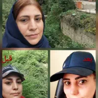 عمل زیبایی بینی در مازندران|خدمات آرایشگری و زیبایی|قائمشهر, |دیوار