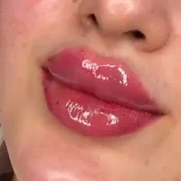 ژل و بوتاکس 550آموزش4م.باکمترین هزینه بدرخشید.|خدمات آرایشگری و زیبایی|شهریار, شهریار|دیوار