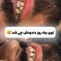 آموزش و کامپوزیت تکنیک جدید|خدمات آرایشگری و زیبایی|اهواز, زیتون کارمندی|دیوار
