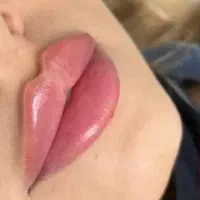 مزوژل/آنزیم/چربی/اگزوزوم/فیلر و ژل ۴۹۰|خدمات آرایشگری و زیبایی|کرج, گوهردشت|دیوار