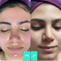 مژده مژده به عروس خانمها گل فیشیال عروس فقط 350|خدمات آرایشگری و زیبایی|اصفهان, خانه اصفهان|دیوار
