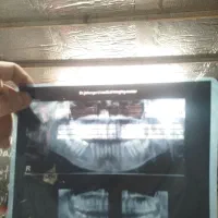 عکس رادیولوژی