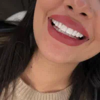 کامپوزیت vip لیرینگ لبه شیشه ایی اقساط  بدون بهره