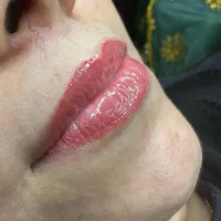 تاتو داعم صورت