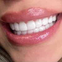 خدمات دندانپزشکی (جشنواره تخفیف های ویژه)